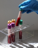 Titelbild des Faltblattes zum Biomonitoring-Workshop 2019 (© BAuA)  Titelbild des Faltblattes zum Biomonitoring-Workshop 2019