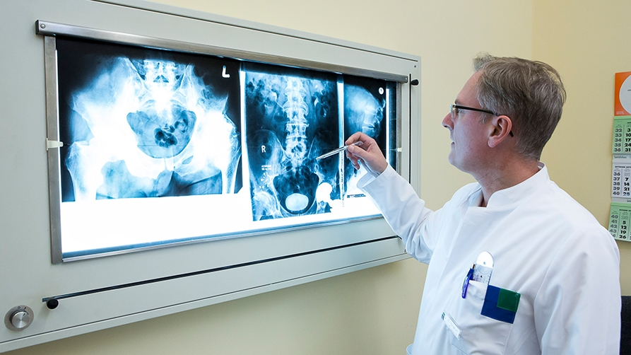 Arzt betrachtet ein Röntgenbild